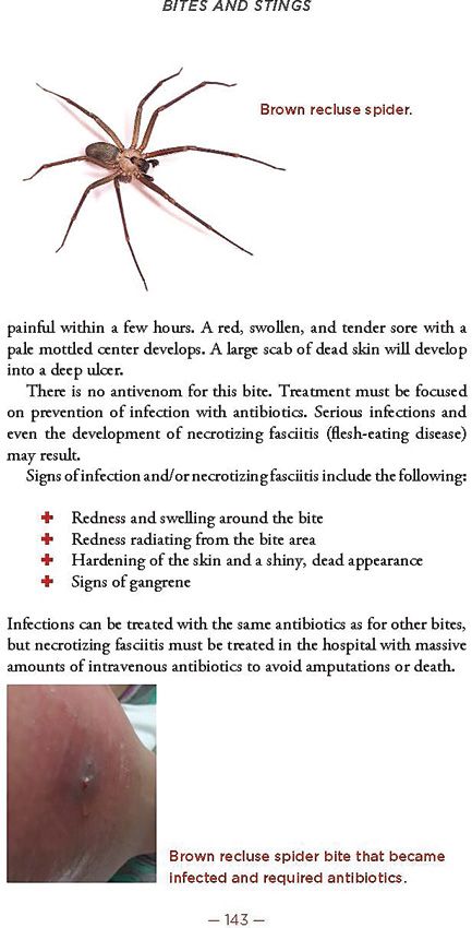 Prepper's Medical Manual - Emergency Care Without Expert Help